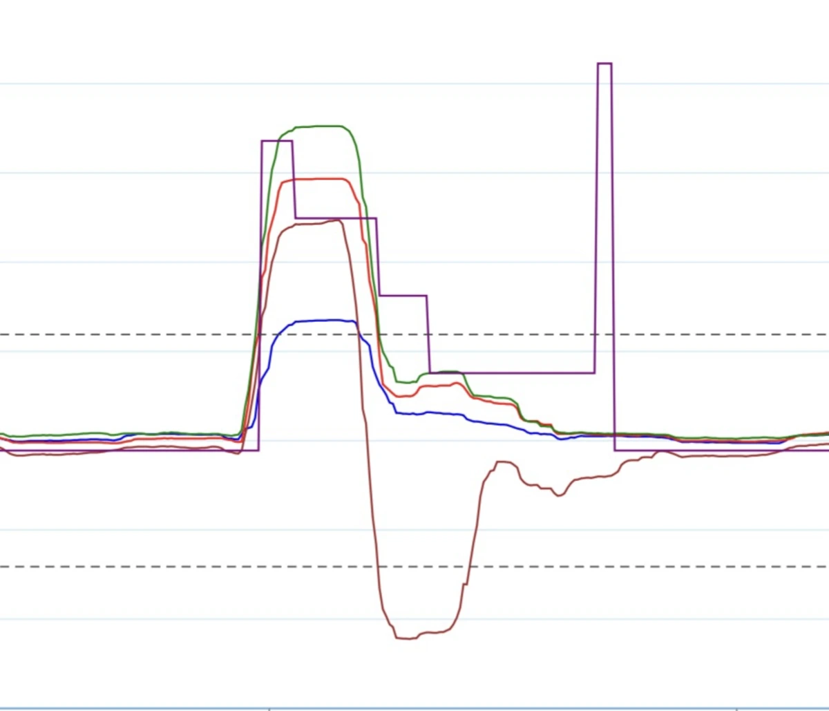 Supplied muscle-activity trace showing a rise during contraction and a return toward baseline during relaxation